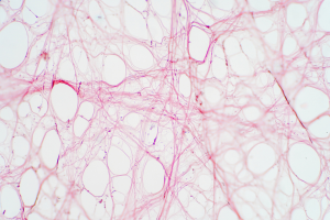 Micrographie d’un tissu conjonctif (fascia) montrant un réseau de fibres rosées entourant des cellules arrondies, illustrant la structure des fascias.