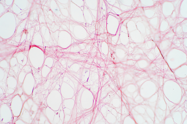 Micrographie d’un tissu conjonctif (fascia) montrant un réseau de fibres rosées entourant des cellules arrondies, illustrant la structure des fascias.